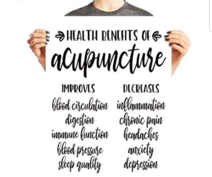 acupuncture benefits